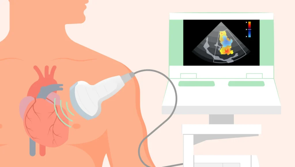 ecografie-cardiaca-scaled
